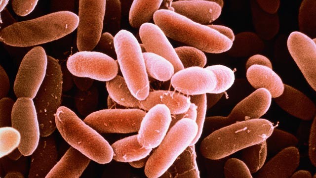 Ảnh 1 của Nhiễm khuẩn Listeria monocytogenes